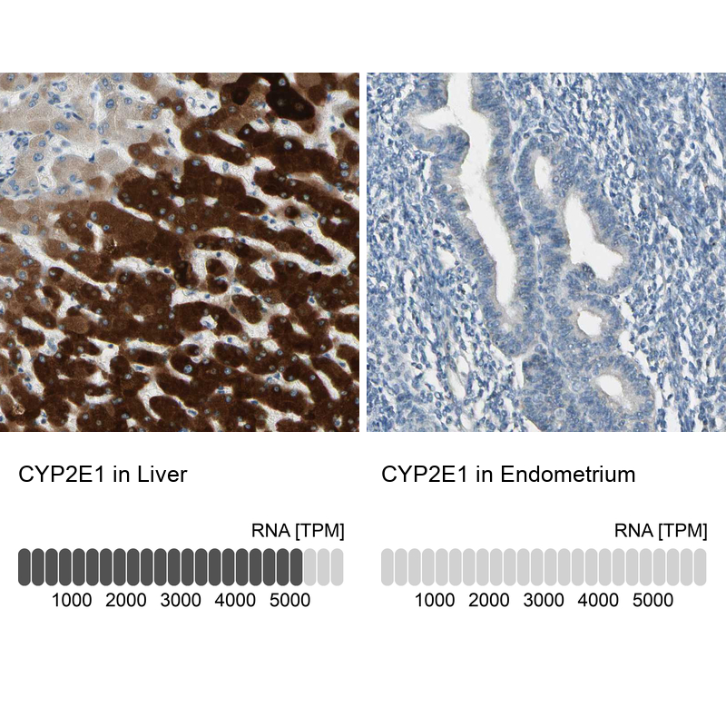 Anti-CYP2E1 Antibody