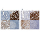 Immunohistochemical staining of human endometrium, liver, liver cancer and tonsil using Anti-CYP2E1 antibody HPA009128 (A) shows similar protein distribution across tissues to independent antibody HPA029564 (B).