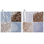 Immunohistochemical staining of human endometrium, liver, liver cancer and tonsil using Anti-CYP2E1 antibody HPA009128 (A) shows similar protein distribution across tissues to independent antibody HPA029564 (B).