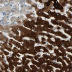 Immunohistochemical staining of human liver shows strong cytoplasmic positivity in hepatocytes.