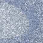 Immunohistochemical staining of human tonsil shows no positivity in germinal center cells as expected.