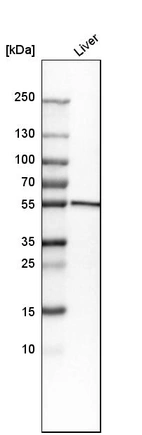 Western blot analysis in human liver tissue.