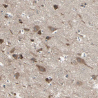 Anti-PNPLA7 Antibody