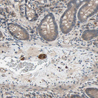 Immunohistochemical staining of human small intestine shows strong cytoplasmic positivity in peripheral ganglion.