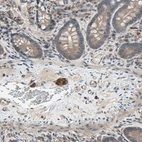 Immunohistochemical staining of human small intestine shows strong cytoplasmic positivity in peripheral ganglion.