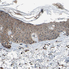 Immunohistochemical staining of human skin shows weak to moderate cytoplasmic positivity in squamous epithelial cells.