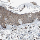 Immunohistochemical staining of human skin shows weak to moderate cytoplasmic positivity in squamous epithelial cells.