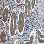 Immunohistochemical staining of human endometrium shows moderate cytoplasmic positivity in glandular cells.