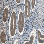 Immunohistochemical staining of human endometrium shows moderate cytoplasmic positivity in glandular cells.