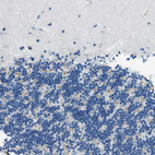 Immunohistochemical staining of human cerebellum shows weak cytoplasmic positivity in cells in granular layer.