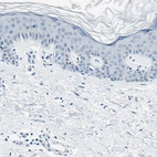 Immunohistochemical staining of human skin shows no positivity in squamous epithelial cells as expected.
