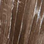 Immunohistochemical staining of human skeletal muscle shows strong cytoplasmic positivity in myocytes.