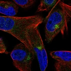Immunofluorescent staining of human cell line RH-30 shows localization to cytosol & the Golgi apparatus.