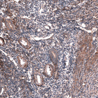 Anti-COL12A1 Antibody