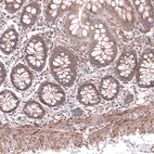 Immunohistochemical staining of human colon shows moderate cytoplasmic positivity in smooth muscle and glandular cells.