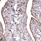 Immunohistochemical staining of human fallopian tube shows moderate cytoplasmic positivity in glandular cells.