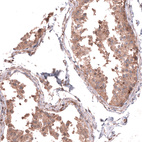 Immunohistochemical staining of human testis shows moderate cytoplasmic positivity in cells in seminiferous ducts.