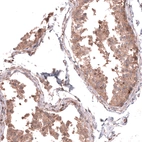 Immunohistochemical staining of human testis shows moderate cytoplasmic positivity in cells in seminiferous ducts.