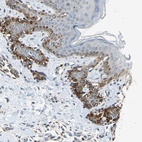 Anti-NPHP3 Antibody