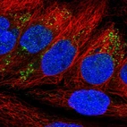 Immunofluorescent staining of human cell line CACO-2 shows localization to vesicles.