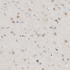 Immunohistochemical staining of human cerebral cortex shows moderate positivity in neurons and glial cells.