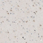 Immunohistochemical staining of human cerebral cortex shows moderate positivity in neurons and glial cells.
