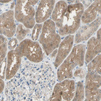 Immunohistochemical staining of human kidney shows moderate cytoplasmic positivity in cells in tubules.