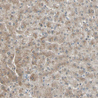 Immunohistochemical staining of human liver shows moderate cytoplasmic positivity in hepatocytes.