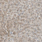 Immunohistochemical staining of human liver shows moderate cytoplasmic positivity in hepatocytes.