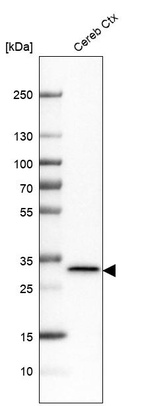 Western blot analysis in human cerebral cortex tissue.