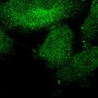 Immunofluorescent staining of human cell line U-251 MG shows localization to nucleoplasm & cytosol.