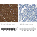 Anti-SLC1A2 Antibody