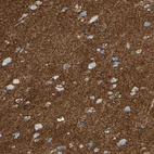 Anti-SLC1A2 Antibody