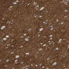 Immunohistochemical staining of human cerebral cortex shows strong membranous positivity in neuropil.