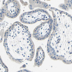 Anti-SLC1A2 Antibody