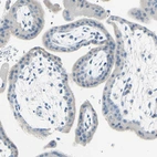 Immunohistochemical staining of human placenta shows no positivity in trophoblastic cells as expected.