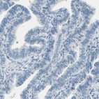 Immunohistochemical staining of human Fallopian tube shows no positivity in glandular cells as expected.