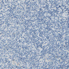Anti-SLC1A2 Antibody