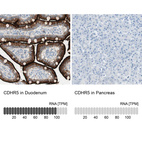 Anti-CDHR5 Antibody