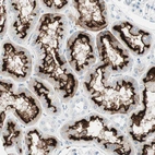 Immunohistochemical staining of human kidney shows strong membranous positivity in cells in tubules.