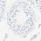 Immunohistochemical staining of human testis shows no positivity in cells in seminiferous ducts as expected.