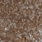 Immunohistochemical staining of human pancreas shows strong cytoplasmic positivity in exocrine glandular cells.
