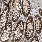 Immunohistochemical staining of human colon shows strong cytoplasmic positivity in glandular cells.