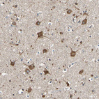 Immunohistochemical staining of human cerebral cortex shows strong cytoplasmic positivity in neuronal cells.