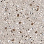 Immunohistochemical staining of human cerebral cortex shows strong cytoplasmic positivity in neuronal cells.