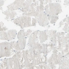 Immunohistochemical staining of human skeletal muscle shows no positivity in myocytes.