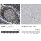 Anti-CD79B Antibody