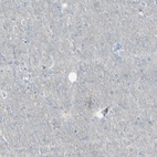 Immunohistochemical staining of human cerebral cortex shows low expression as expected.