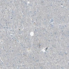 Immunohistochemical staining of human cerebral cortex shows low expression as expected.