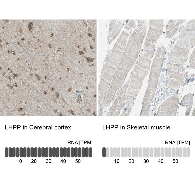 Anti-LHPP Antibody